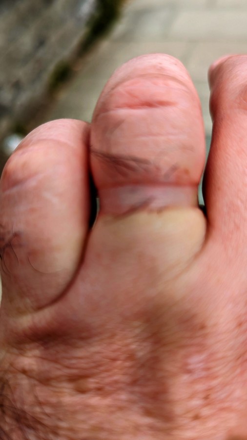 AN EMERGENCY PROCEDURE IN&nbsp;LIVERPOOL